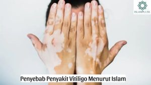 Penyebab Penyakit Vitiligo Menurut Islam